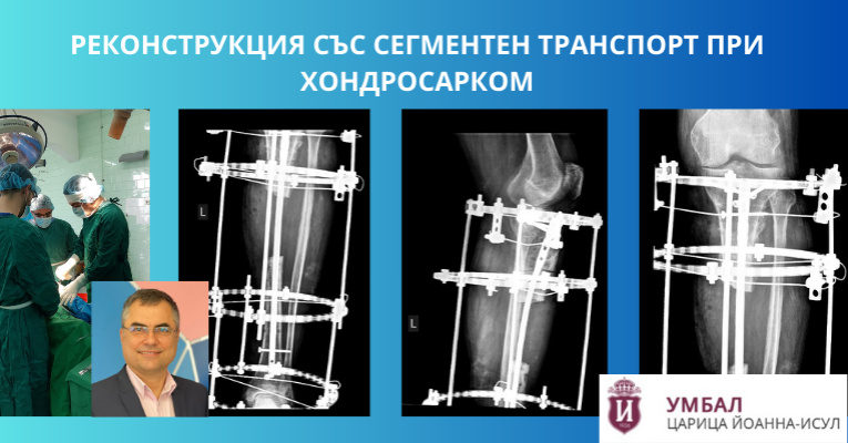Проф. д-р Кинов спаси крака на пациент с хондросарком, 16-сантиметров дефект и тежка инфекция | ИСУЛ